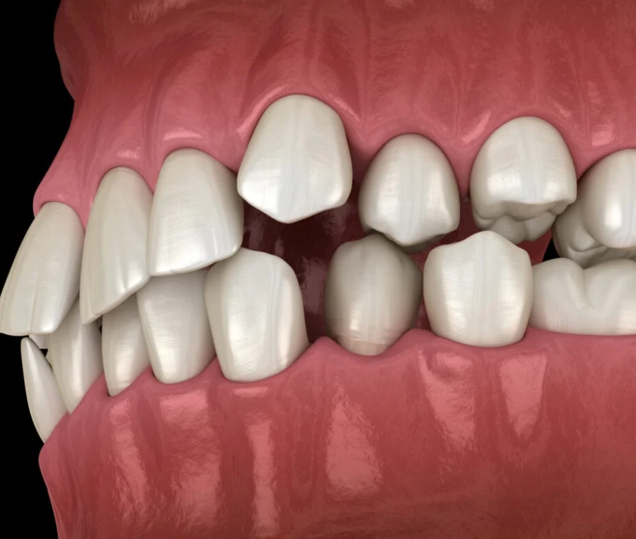 Görsel ALT Başlığı