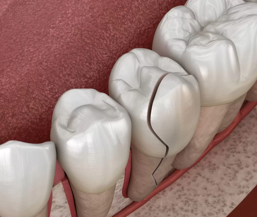 Görsel ALT Başlığı