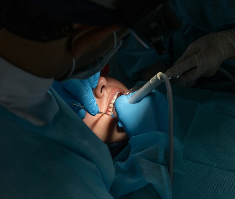 Gömülü 20’lik Diş Çekimi