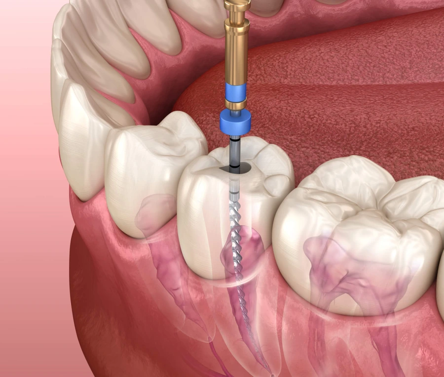 Görsel ALT Başlığı