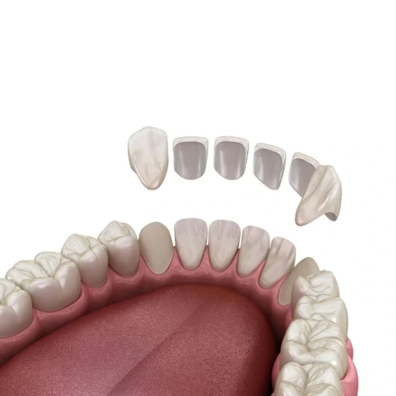 Görsel ALT Başlığı