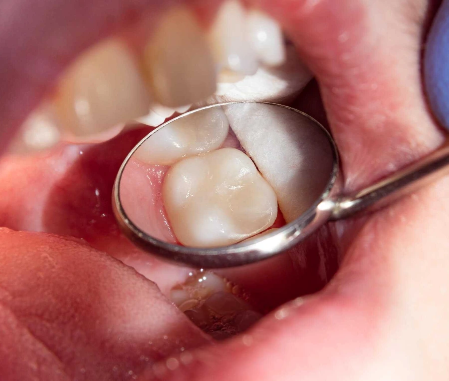 Görsel ALT Başlığı