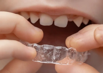 Şeffaf Diş Telleri Nedir ve Ne İşe Yarar?