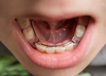 Dişlerinize Nasıl Bakmalısınız: Kapsamlı Bir Rehber