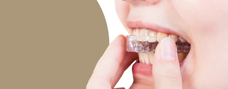 Kaynar Su ile Ağız Koruyucu Nasıl Şekillendirilir?