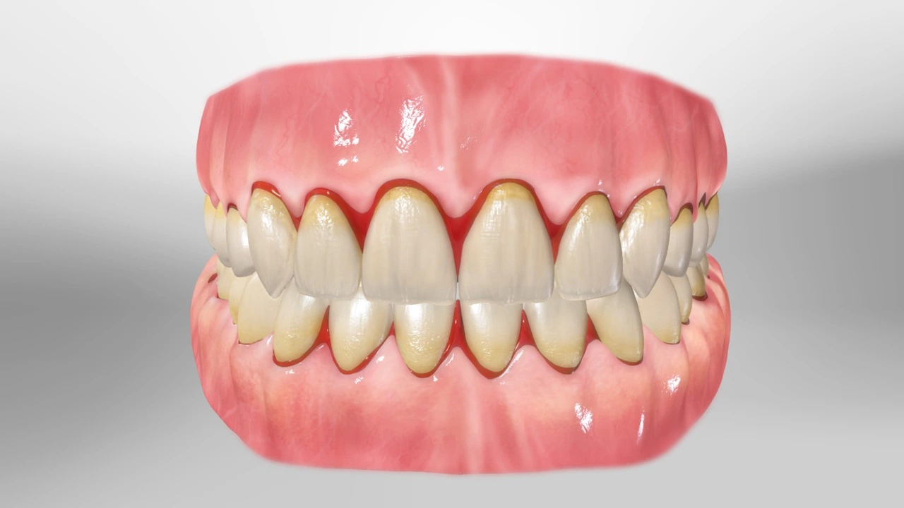 Gesundes Zahnfleisch erhalten - Tipps zur täglichen Zahnfleischpflege