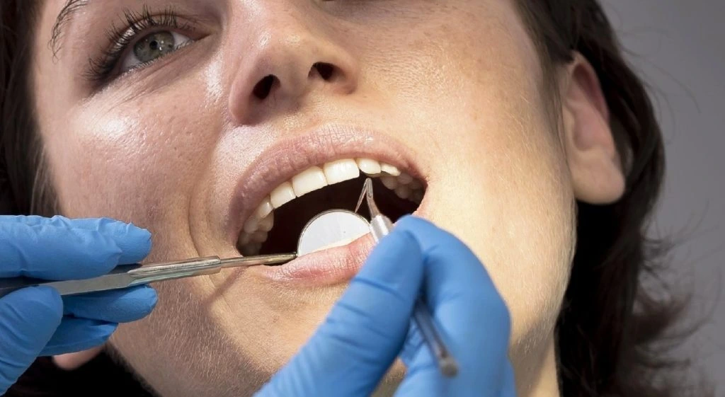 Diş Şeffaflaşması Nasıl Anlaşılır ve 3 Farklı Tedavi Yöntemi