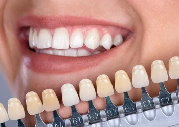 Estetik Diş Hekimliğinde En Popüler 5 Gülüş Tasarımı İşlemi