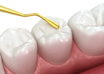 Kompozit Dolgu Nedir? Kompozit Dolgu Fiyatları