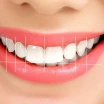 Gülüş Tasarımımın 7 İlkesi Nedir?