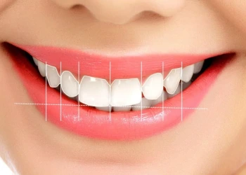 Gülüş Tasarımımın 7 İlkesi Nedir?