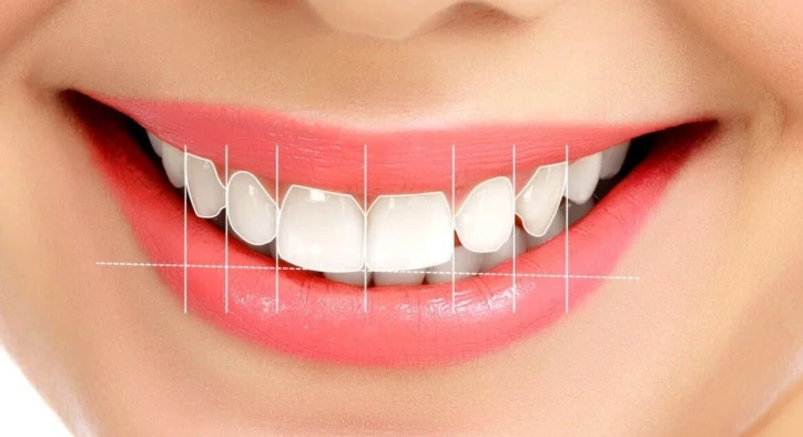 Gülüş Tasarımımın 7 İlkesi Nedir?