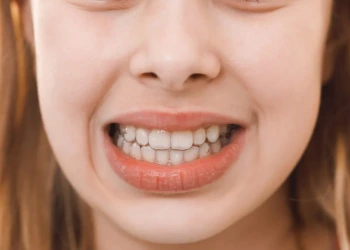 Maloklüzyon Nedir? Nasıl Tedavi Edilir?