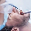What is Sinus Lifting? Surgery and Recovery Process
