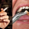 Diş Çekiminden Sonra Sigara İçilir mi?