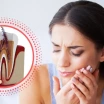 Pain After Root Canal Treatment: Duration & Relief Guide