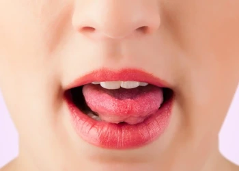What Is Oral Cancer? Symptoms, Stages, and Current Treatment