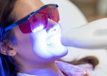 Wie lassen sich empfindliche Zähne nach dem Bleaching lindern? Dauer und Lösungen