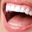 What is Monolithic Zirconia? Costs, Benefits & Differences