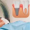 Do Dental Implants Interfere with MRI Scans?