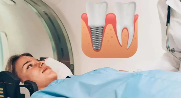 Do Dental Implants Interfere with MRI Scans?