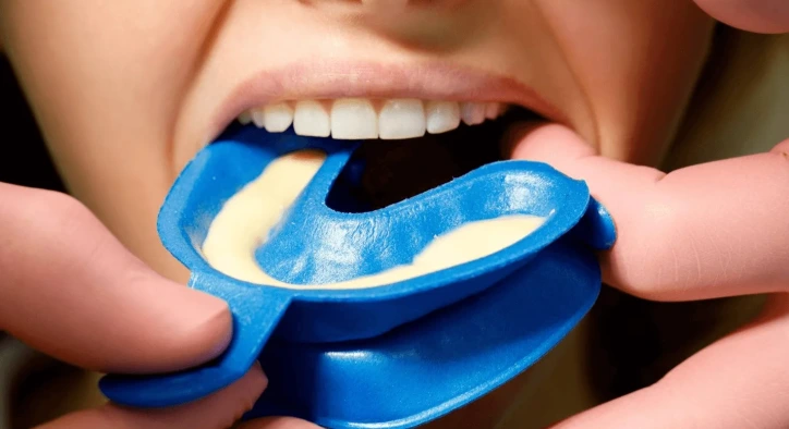 What Is Fluoride Treatment? Procedure, Cavity Prevention and Costs