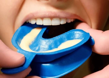 Florür Tedavisi Nedir? Nasıl Yapılır, Çürük Önleme ve Fiyatları
