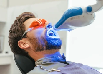How Is Laser Teeth Whitening Performed? Longevity and Prices