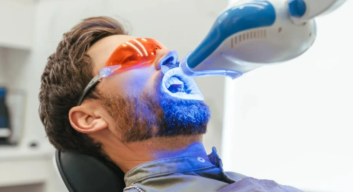 How Is Laser Teeth Whitening Performed? Longevity and Prices